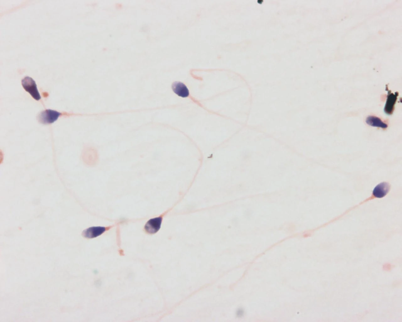 razmer-spermatozoida-detalnyy-analiz-mikroskopicheskikh-parametrov-62df