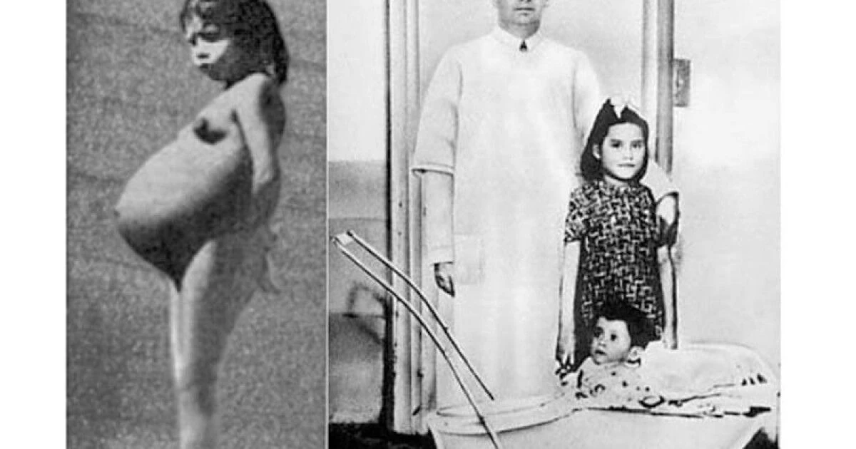 Самая молодая мама в мире: история Лины Медины, родившей в 5 лет